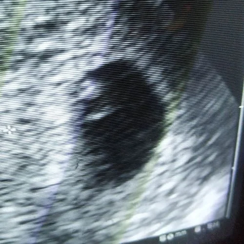 "Una delle prime foto di Damiano"